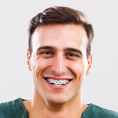 Adult orthodontics and braces for adults