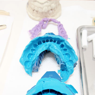The Invisalign process for teens and adults
